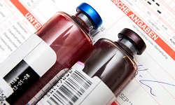 Blood Culture